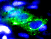 Superposição de imunofluorescência para núcleo (azul) e desmina (verde)